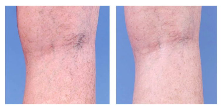 Kosmētiskā korekcija